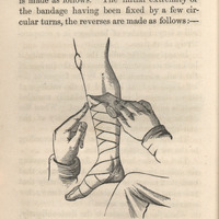  Image of bandaging leg file Woodward02 